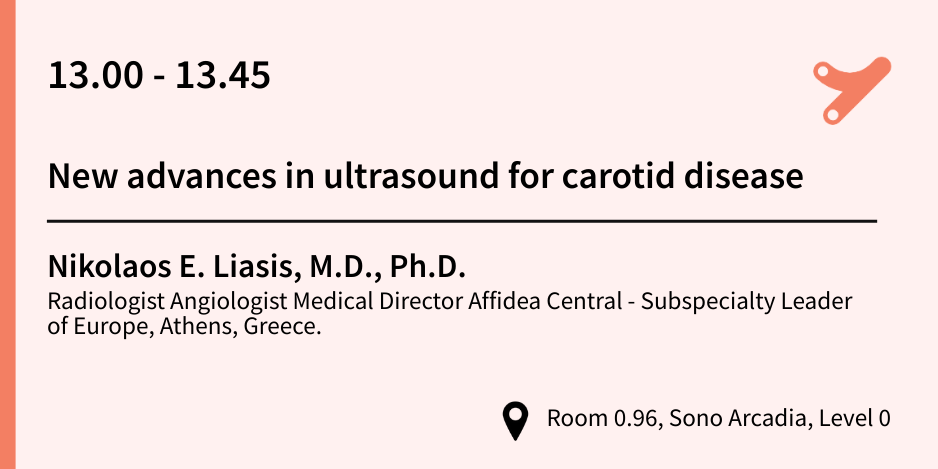 New advances in ultrasound for carotid disease